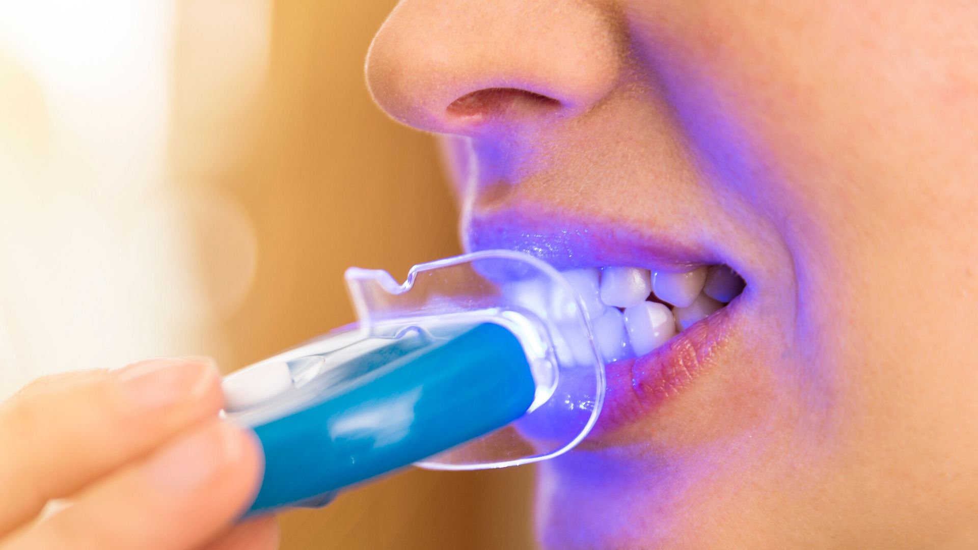 Blanchir les dents chez soi