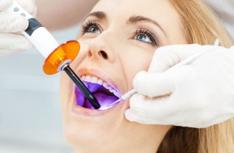 Blanchir les dents aux UV